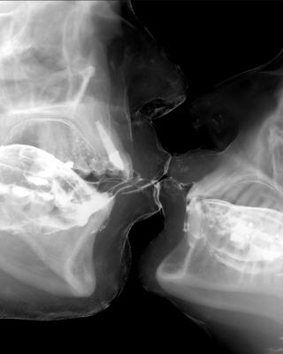 Radiografia de un beso